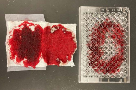 A photo of gauze pads with alginate-glycerol powder (left) soaked in period blood, with a 96-well plate filled with menstrual blood (right) on a black lab bench.